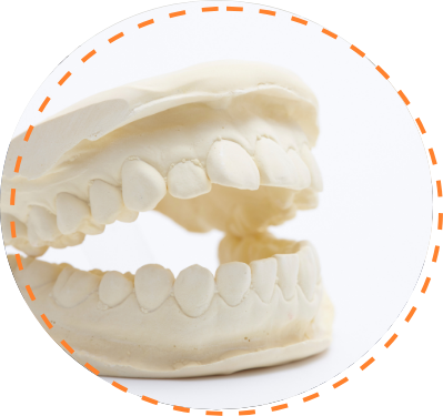 歯の模型分析・口腔内写真