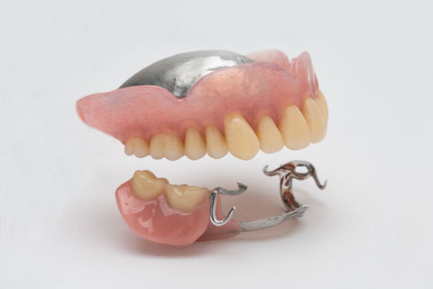 歯とお口の型取り